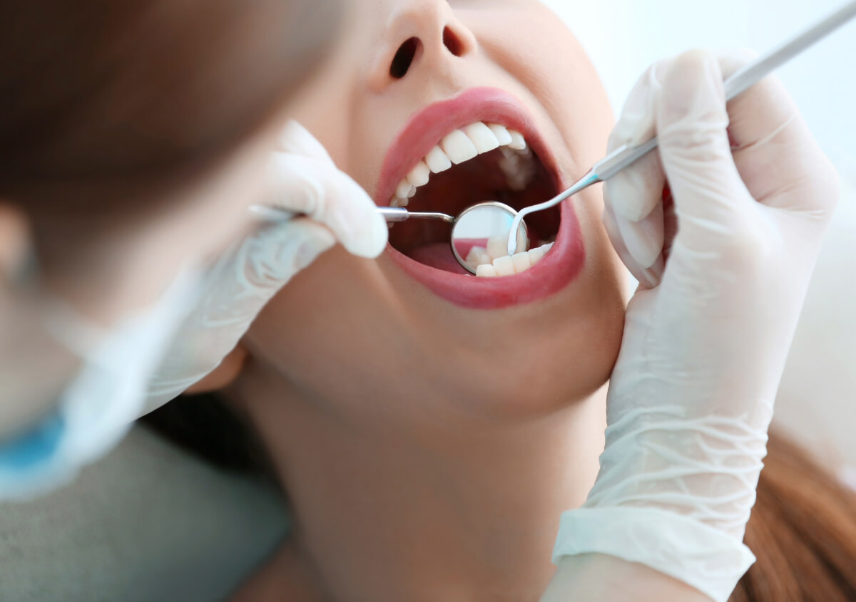 Good Teeth Whitening in West Bend WI area